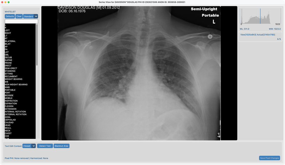 Series View on davidson_cxr