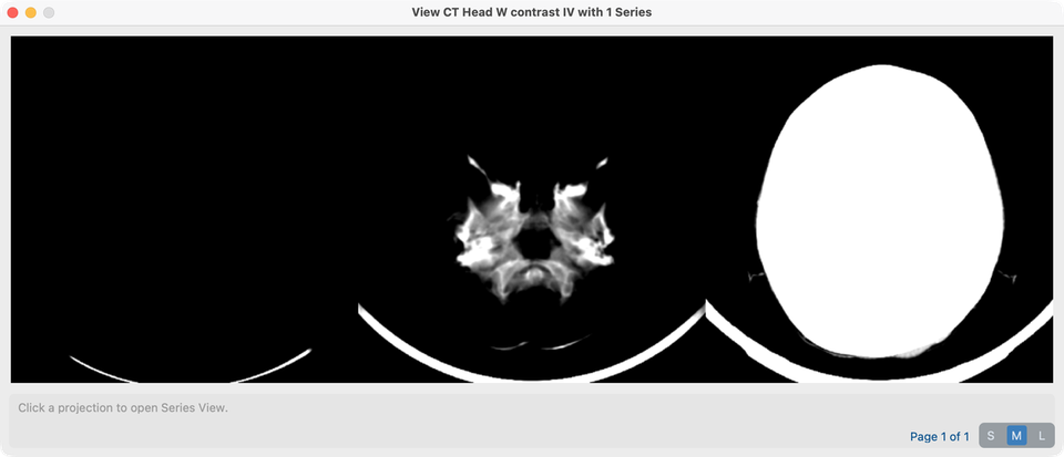 View Projections for a selected study