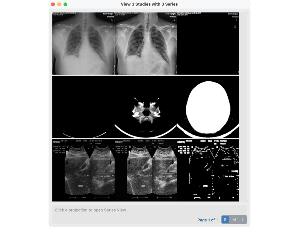 View Projections for multiple selected studies