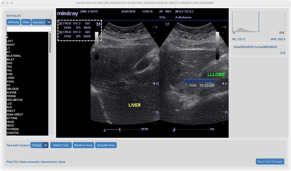 Exclude Area on us_rgb_single_frame parameter block