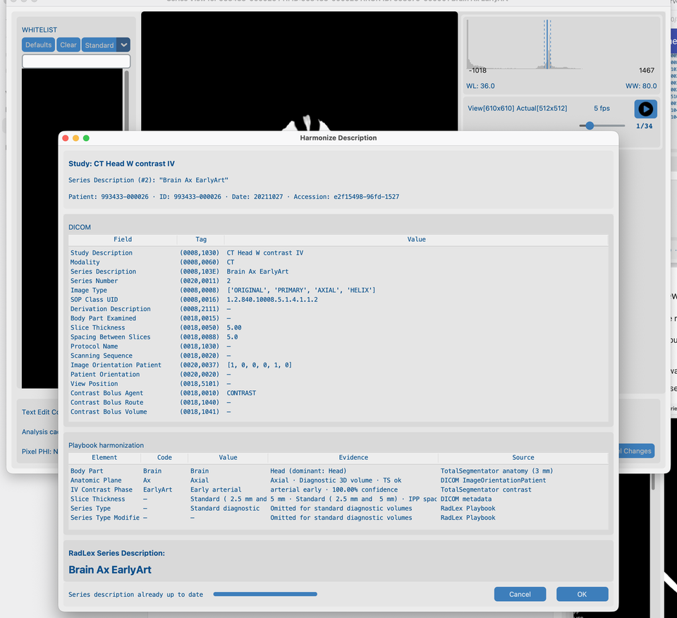 Series View with completed Harmonize Description results