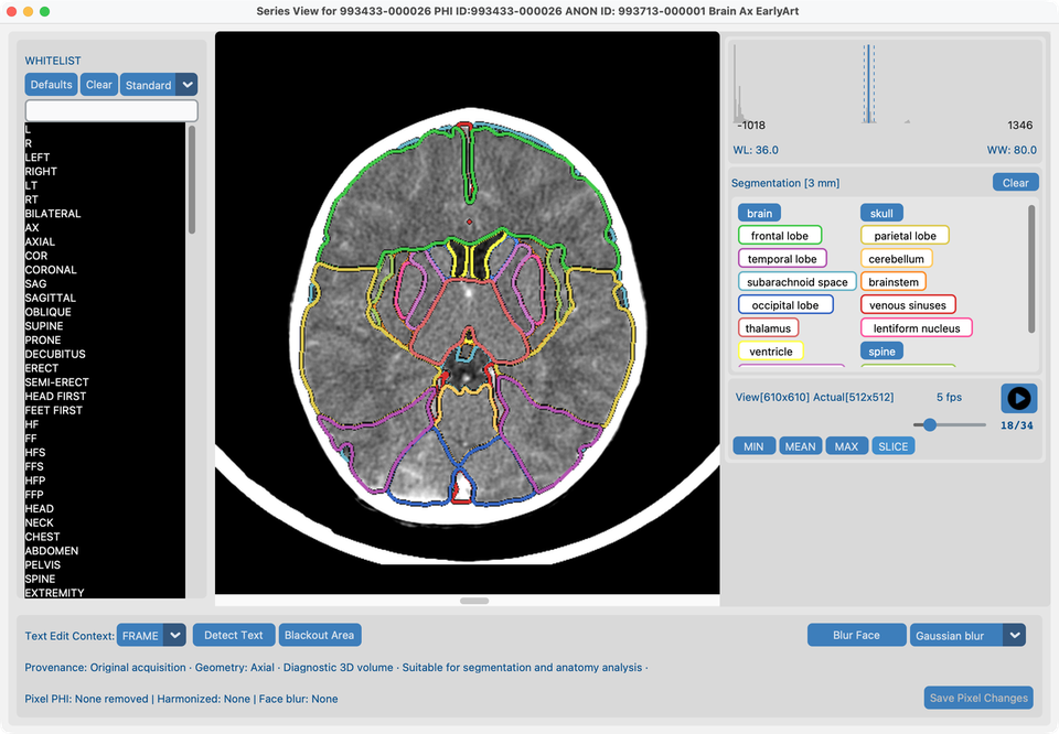 Series View with all brain segments on the middle slice