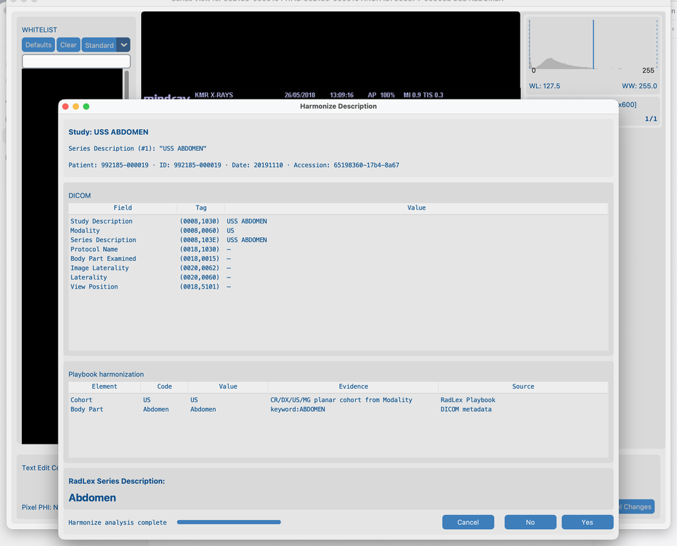 us_rgb_single_frame Series View above planar Harmonize (metadata-only)