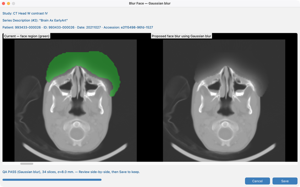 Face Blur Gaussian on CT_Head_With_Contrast
