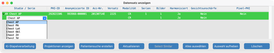 Datensatz-Dropdown Serienbeschreibung (RadLex)