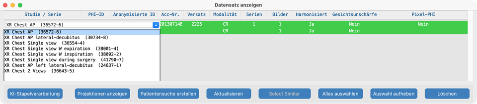 Datensatz-Dropdown Studienbeschreibung (LOINC)