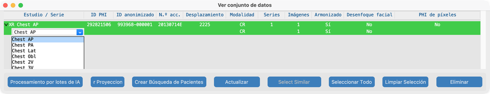 Desplegable de descripción de serie del Conjunto de datos (RadLex)