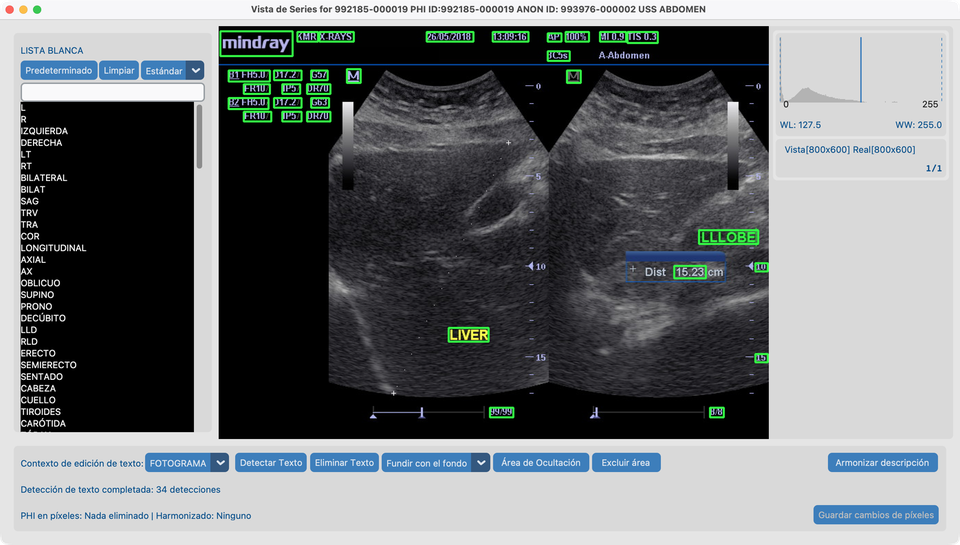Detectar Texto en us_rgb_single_frame
