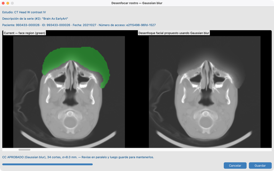 Desenfoque facial Gaussian en CT_Head_With_Contrast