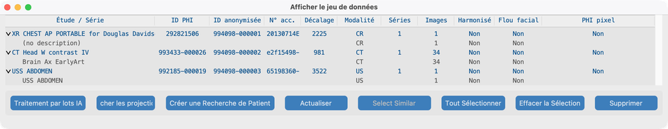 Arbre Jeu de données avec études de test