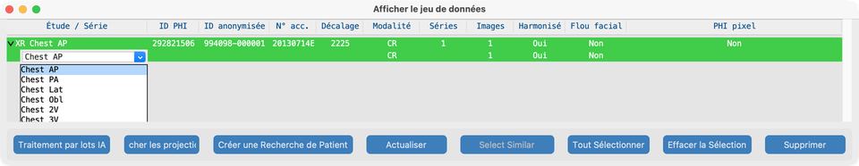 Liste déroulante description de série Jeu de données (RadLex)
