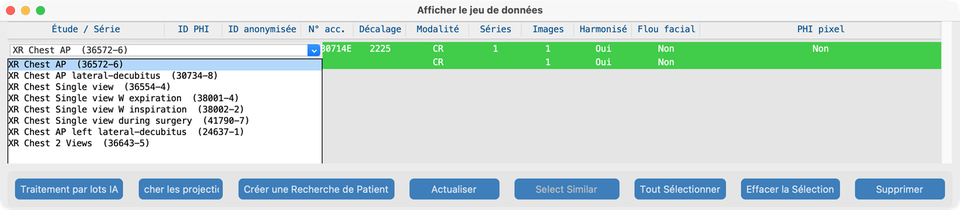 Liste déroulante description d’étude Jeu de données (LOINC)