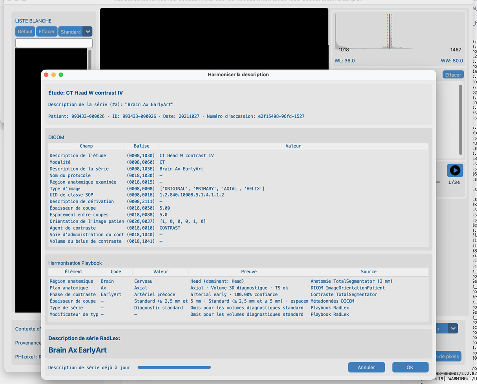 Vue des séries avec résultats Harmoniser la description terminés