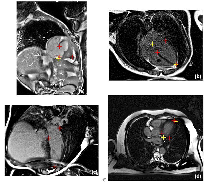 A close-up of a ct scan AI-generated content may be incorrect.
